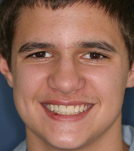 See Case Study of This Smile